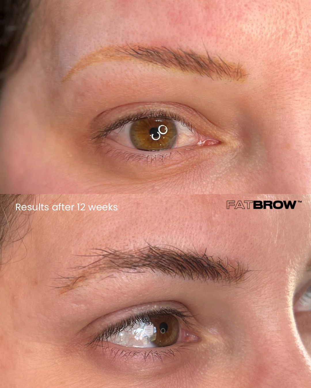 FATBROW The Serum