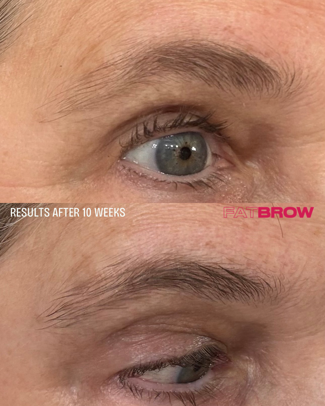 FATBROW The Serum